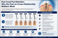 Root Canal Post Retention: Why the Post-to-Crown Relationship Matters Most