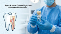 Post and Core Dental Systems for Strong & Reliable Restorations